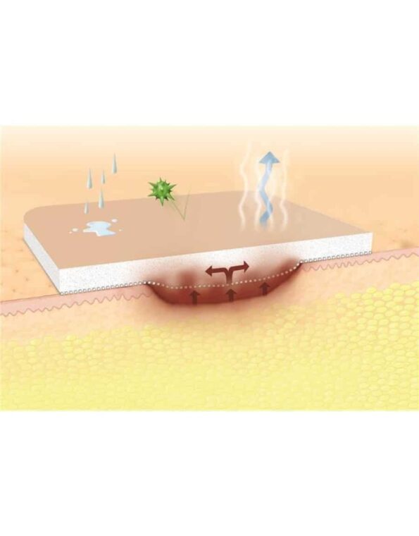 SUPRASORB P NO ADHESIVO-2-900×1150